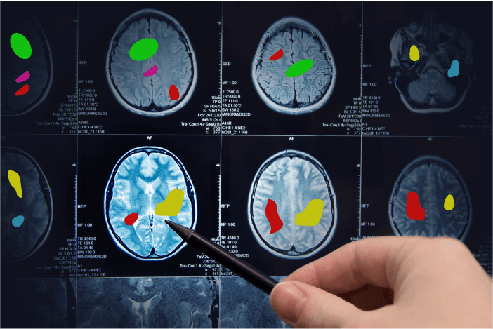 image annotation in Healthcare and Medical Imaging.